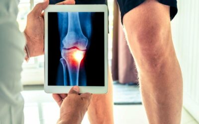 Knee Cartilage Replacement Alternatives